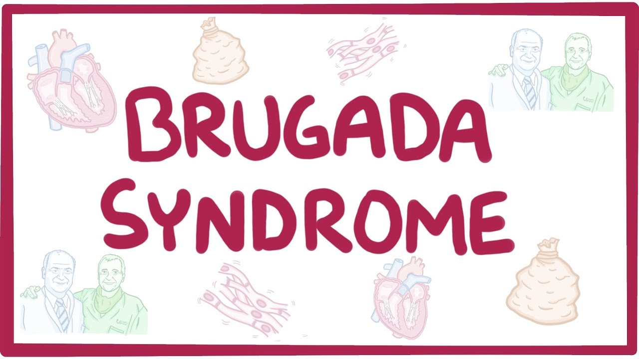 Brugada syndrome market